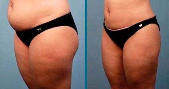 Cómo perder 10 kg en un mes